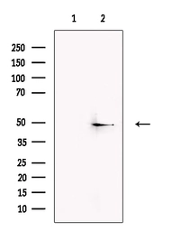 Anti-Trek1 antibody used in Western Blot (WB). GTX04112