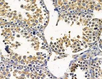 Anti-GNAI1 antibody used in IHC (Paraffin sections) (IHC-P). GTX04113