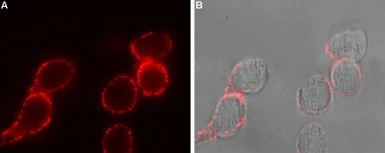 Anti-ADCY3 antibody used in Immunocytochemistry/ Immunofluorescence (ICC/IF). GTX04114