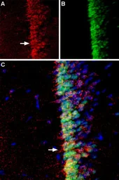 Anti-ADCY3 antibody used in IHC (Free Floating) (IHC (Free Floating)). GTX04114