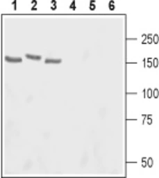 Anti-ADCY3 antibody used in Western Blot (WB). GTX04114