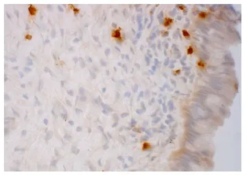 Goat Anti-Human IgD (Heavy chain) antibody, pre-adsorbed (Biotin). GTX04123-02