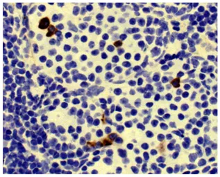 Goat Anti-Mouse IgA (Heavy chain) antibody, pre-adsorbed (HRP). GTX04200-01