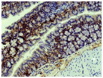 Goat Anti-Mouse IgA (Heavy chain) antibody, pre-adsorbed (HRP). GTX04200-01