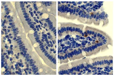 Rat Anti-Mouse IgD antibody [11-26]. GTX04223