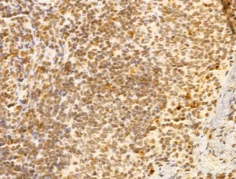 Anti-FBXL14 antibody used in IHC (Paraffin sections) (IHC-P). GTX04235