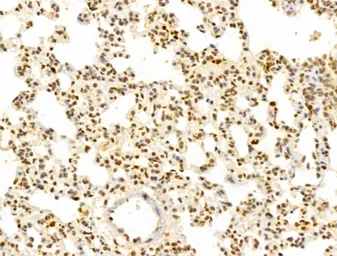 Anti-FBXL14 antibody used in IHC (Paraffin sections) (IHC-P). GTX04235