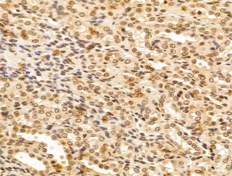 Anti-FBXL14 antibody used in IHC (Paraffin sections) (IHC-P). GTX04235
