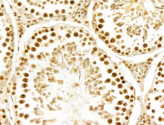 Anti-FBXL14 antibody used in IHC (Paraffin sections) (IHC-P). GTX04235