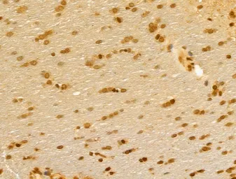 Anti-FBXL14 antibody used in IHC (Paraffin sections) (IHC-P). GTX04235