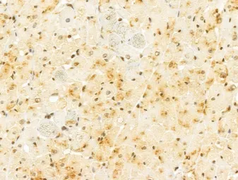 Anti-FBXL14 antibody used in IHC (Paraffin sections) (IHC-P). GTX04235