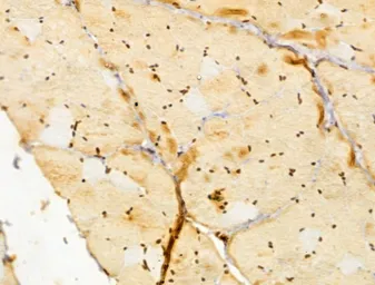 Anti-FBXL14 antibody used in IHC (Paraffin sections) (IHC-P). GTX04235