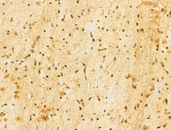 Anti-FBXL14 antibody used in IHC (Paraffin sections) (IHC-P). GTX04235