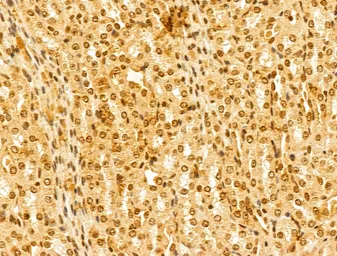 Anti-FBXL14 antibody used in IHC (Paraffin sections) (IHC-P). GTX04235