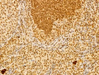 Anti-FBXL14 antibody used in IHC (Paraffin sections) (IHC-P). GTX04235