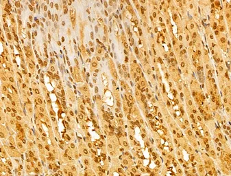 Anti-FBXL14 antibody used in IHC (Paraffin sections) (IHC-P). GTX04235