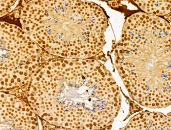 Anti-FBXL14 antibody used in IHC (Paraffin sections) (IHC-P). GTX04235