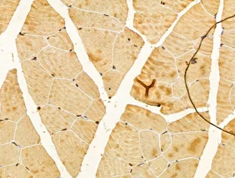Anti-FBXL14 antibody used in IHC (Paraffin sections) (IHC-P). GTX04235