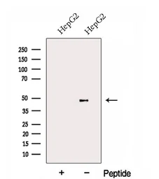 Anti-FBXL14 antibody used in Western Blot (WB). GTX04235