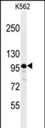 Anti-SE6L2 antibody used in Western Blot (WB). GTX04237