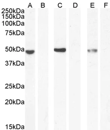 Anti-NAT8L antibody used in Western Blot (WB). GTX04238
