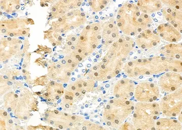 Anti-RFC4 antibody used in IHC (Paraffin sections) (IHC-P). GTX04241