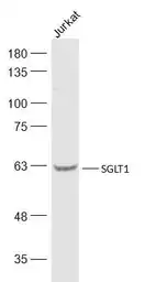 Anti-SGLT1 antibody used in Western Blot (WB). GTX04243