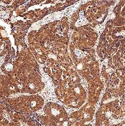 Anti-CIP2A antibody [2G10] used in IHC (Paraffin sections) (IHC-P). GTX04245