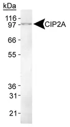 Anti-CIP2A antibody [2G10] used in Western Blot (WB). GTX04245