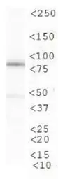 Anti-CIP2A antibody [2G10] used in Western Blot (WB). GTX04245