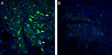 Anti-5-HT2A receptor antibody used in IHC (Frozen sections) (IHC-Fr). GTX04247