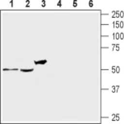 Anti-5-HT2A receptor antibody used in Western Blot (WB). GTX04247