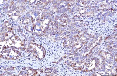 Anti-CD155 antibody [5I13D1] used in IHC (Paraffin sections) (IHC-P). GTX04249