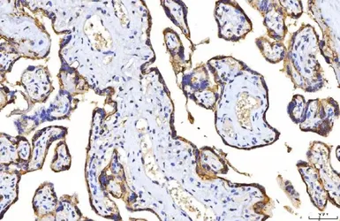 Anti-CD155 antibody [5I13D1] used in IHC (Paraffin sections) (IHC-P). GTX04249