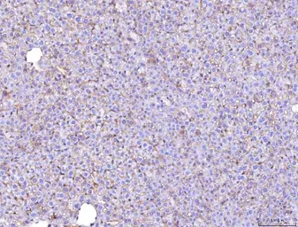Anti-CD155 antibody [5I13D1] used in IHC (Paraffin sections) (IHC-P). GTX04249