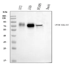Anti-CD155 antibody [5I13D1] used in Western Blot (WB). GTX04249