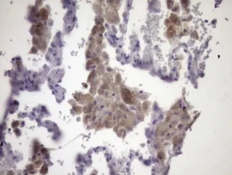 Anti-CIP2A antibody [OTI9E6] used in IHC (Paraffin sections) (IHC-P). GTX04253