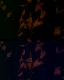 Anti-NALP1 antibody used in Immunocytochemistry/ Immunofluorescence (ICC/IF). GTX04254