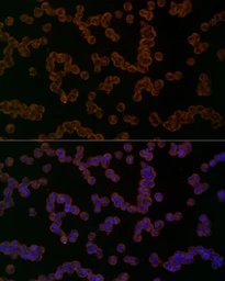 Anti-NALP1 antibody used in Immunocytochemistry/ Immunofluorescence (ICC/IF). GTX04254