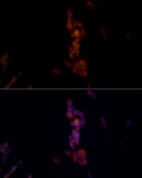 Anti-NALP1 antibody used in Immunocytochemistry/ Immunofluorescence (ICC/IF). GTX04254
