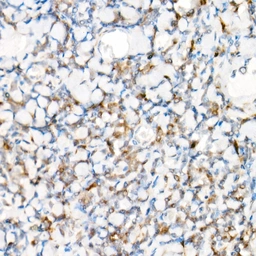 Anti-NALP1 antibody used in IHC (Paraffin sections) (IHC-P). GTX04254