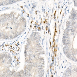 Anti-NALP1 antibody used in IHC (Paraffin sections) (IHC-P). GTX04254