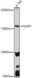 Anti-NALP1 antibody used in Western Blot (WB). GTX04254