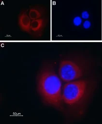Anti-TMEM38B antibody used in Immunocytochemistry/ Immunofluorescence (ICC/IF). GTX04255