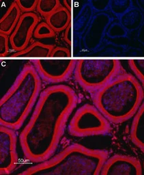 Anti-TMEM38B antibody used in IHC (Paraffin sections) (IHC-P). GTX04255