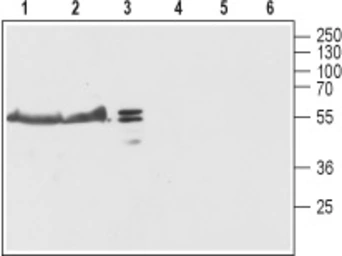 Anti-TMEM38B antibody used in Western Blot (WB). GTX04255