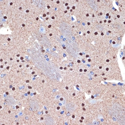 Anti-CTIP2 antibody [ARC2329] used in IHC (Paraffin sections) (IHC-P). GTX04256