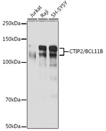 Anti-CTIP2 antibody [ARC2329] used in Western Blot (WB). GTX04256