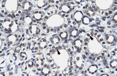 Anti-AIRE antibody used in IHC (Paraffin sections) (IHC-P). GTX04257