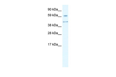 Anti-AIRE antibody used in Western Blot (WB). GTX04257